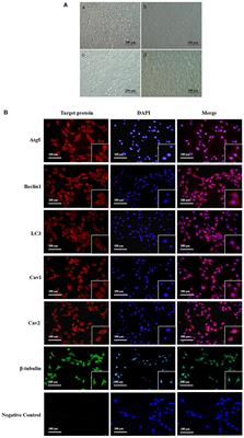 Epidermal growth factor regulates autophagy activity and endocytosis of yak cumulus cells in a concentration-dependent manner